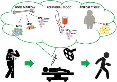 Son of a Lesser God: The Case of Cell Therapy for Refractory Angina